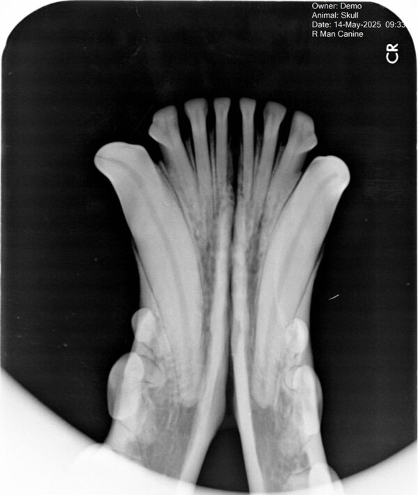 Apixia Digital Dental Radiology Scanner sample image 10