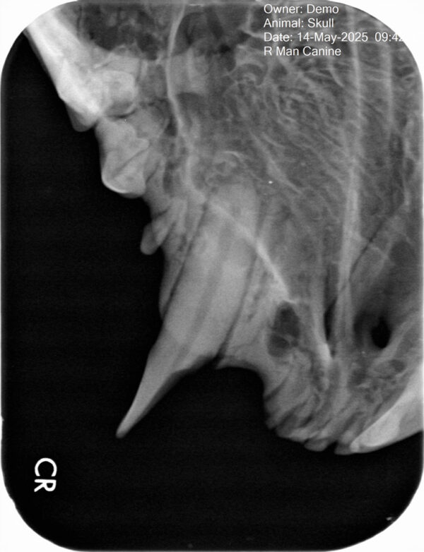 Apixia Digital Dental Radiology Scanner sample image 8