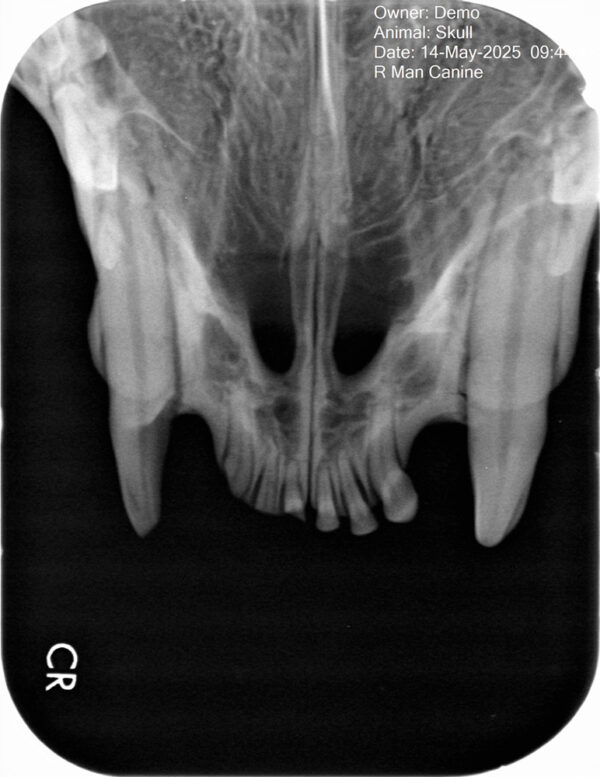 Apixia Digital Dental Radiology Scanner sample image 7