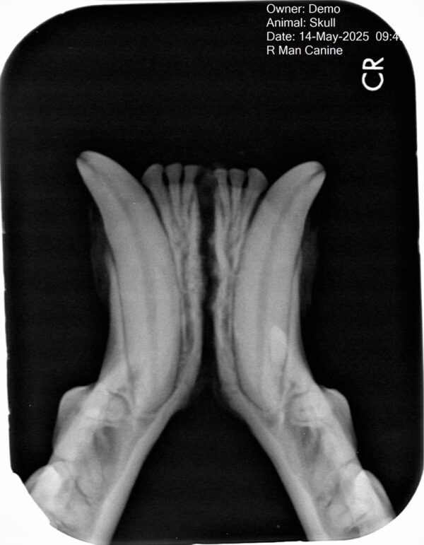 Apixia Digital Dental Radiology Scanner sample image 6
