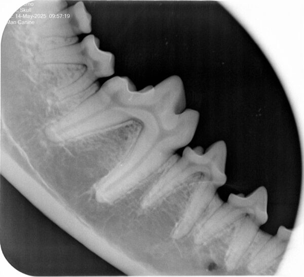 Apixia Digital Dental Radiology Scanner sample image 5