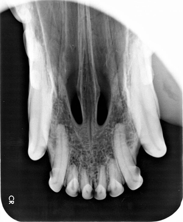 Apixia Digital Dental Radiology Scanner sample image 4
