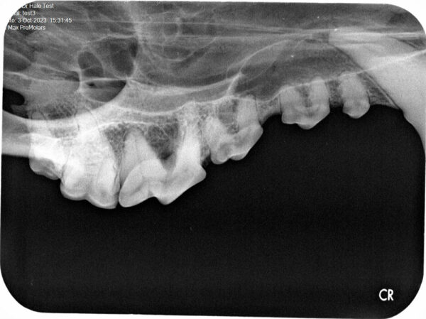 Apixia Digital Dental Radiology Scanner sample image 21