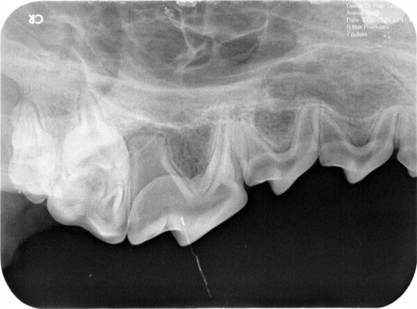 Apixia Digital Dental Radiology Scanner sample image 15
