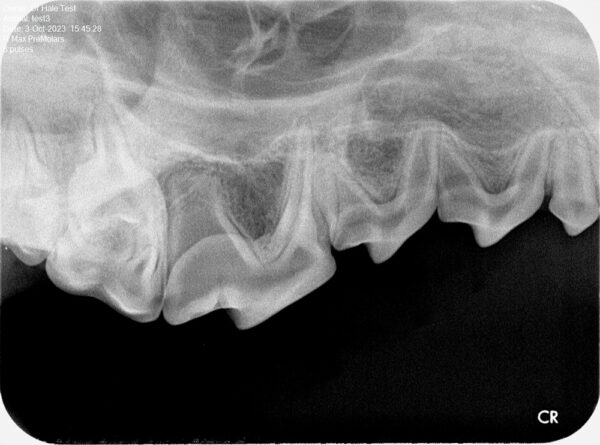 Apixia Digital Dental Radiology Scanner sample image 18