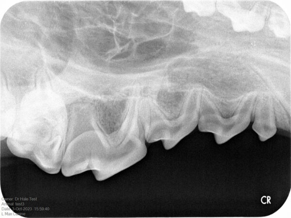 Apixia Digital Dental Radiology Scanner sample image 17