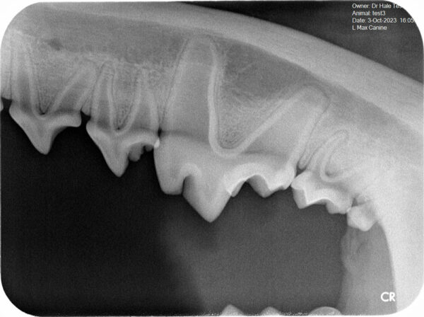 Apixia Digital Dental Radiology Scanner sample image 14