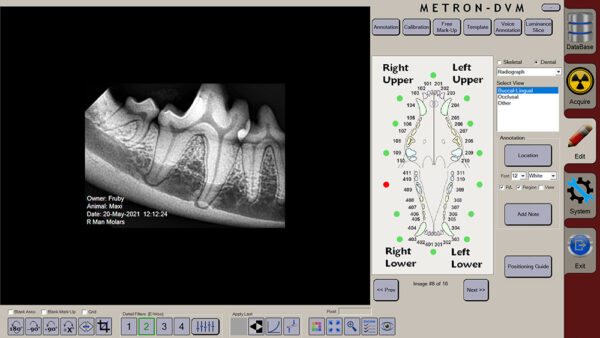 apixia Digital Dental Radiology Scanner - Image 9