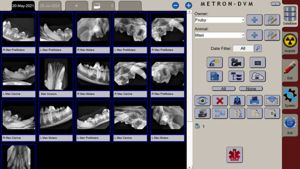 apixia Digital Dental Radiology Scanner - Image 8