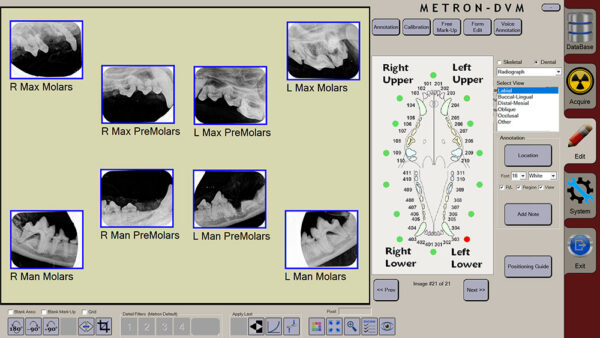 apixia Digital Dental Radiology Scanner - Image 7