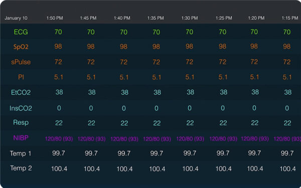 LifeWindow Lite Series tabular representation of patient data