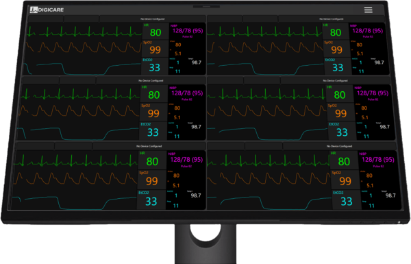 CentralVue CV10x device