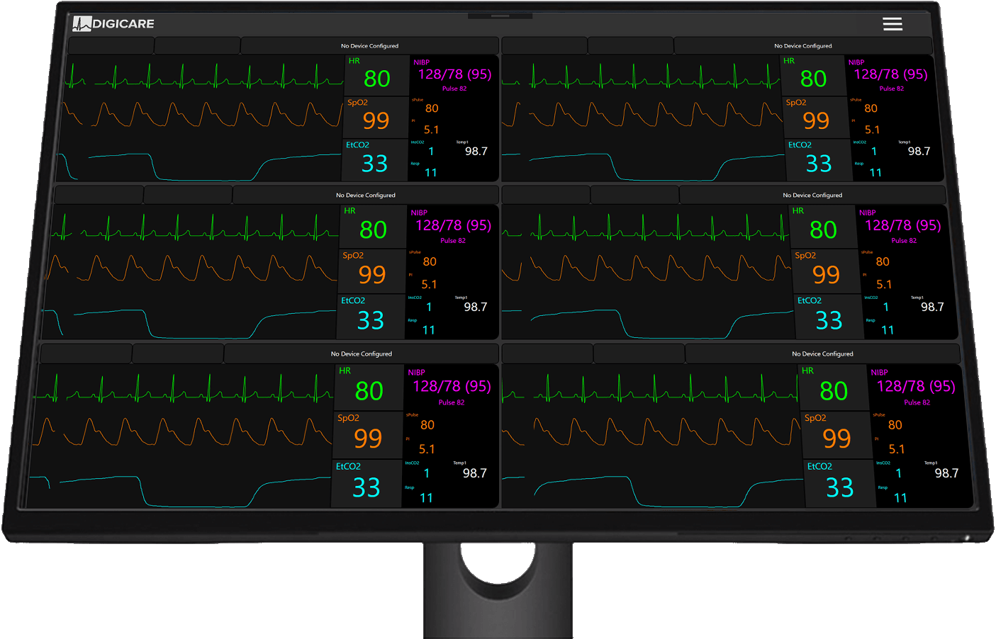 CentralVue CV10x device