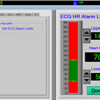LifeWindow Lite 9x MRI Alarm
