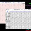 LifeWindow Lite 9x MRI Records