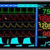 LifeWindow Lite 9x MRI Waveform