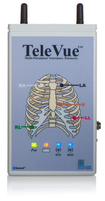 TeleVUE TV2x Device