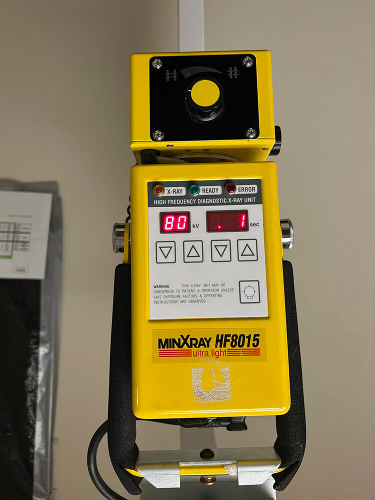 MinXray HF8015 Portable X-ray