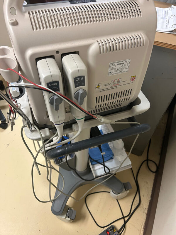 SonoScape S8 Ultrasound Machine