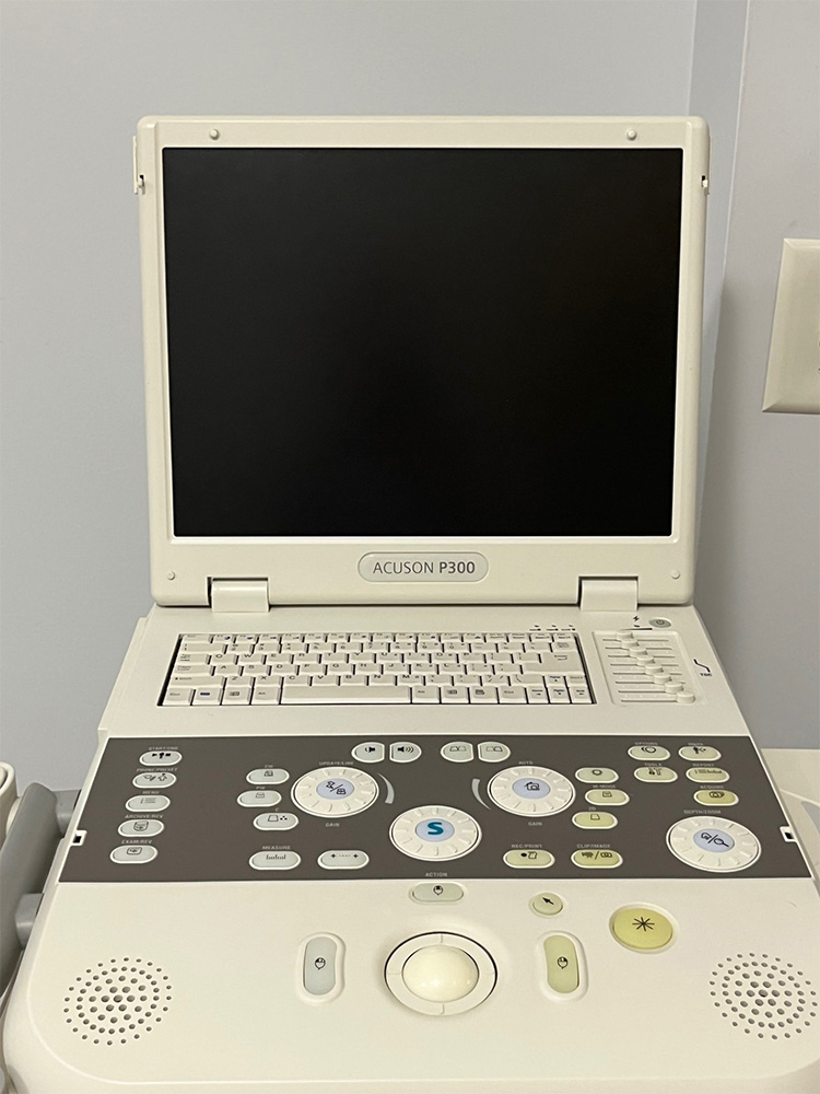 Siemens ACUSON P300 Ultrasound